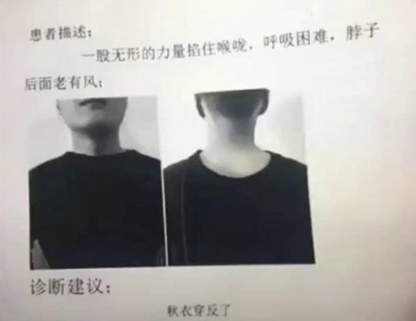 易宝配资 男子双手发黑以为患上血栓，医生一检查哭笑不得...